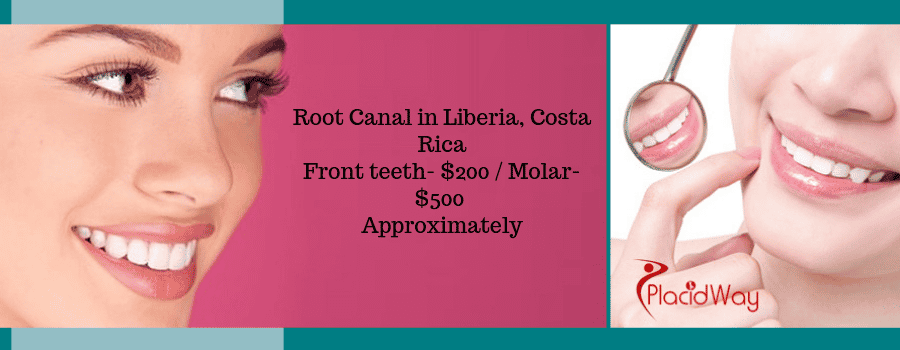 Root Canal in Liberia, Costa Rica